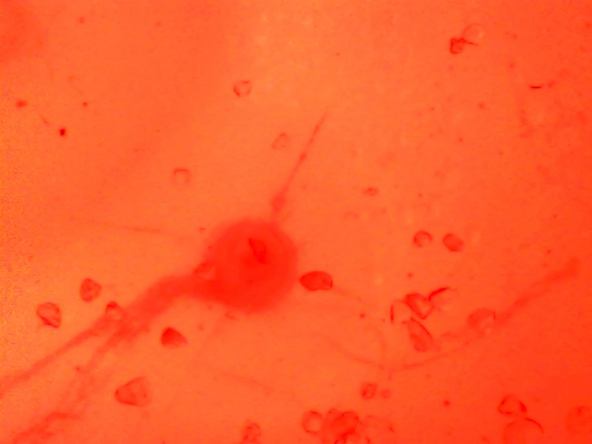 Microscopic Vision Restoration — plate 3