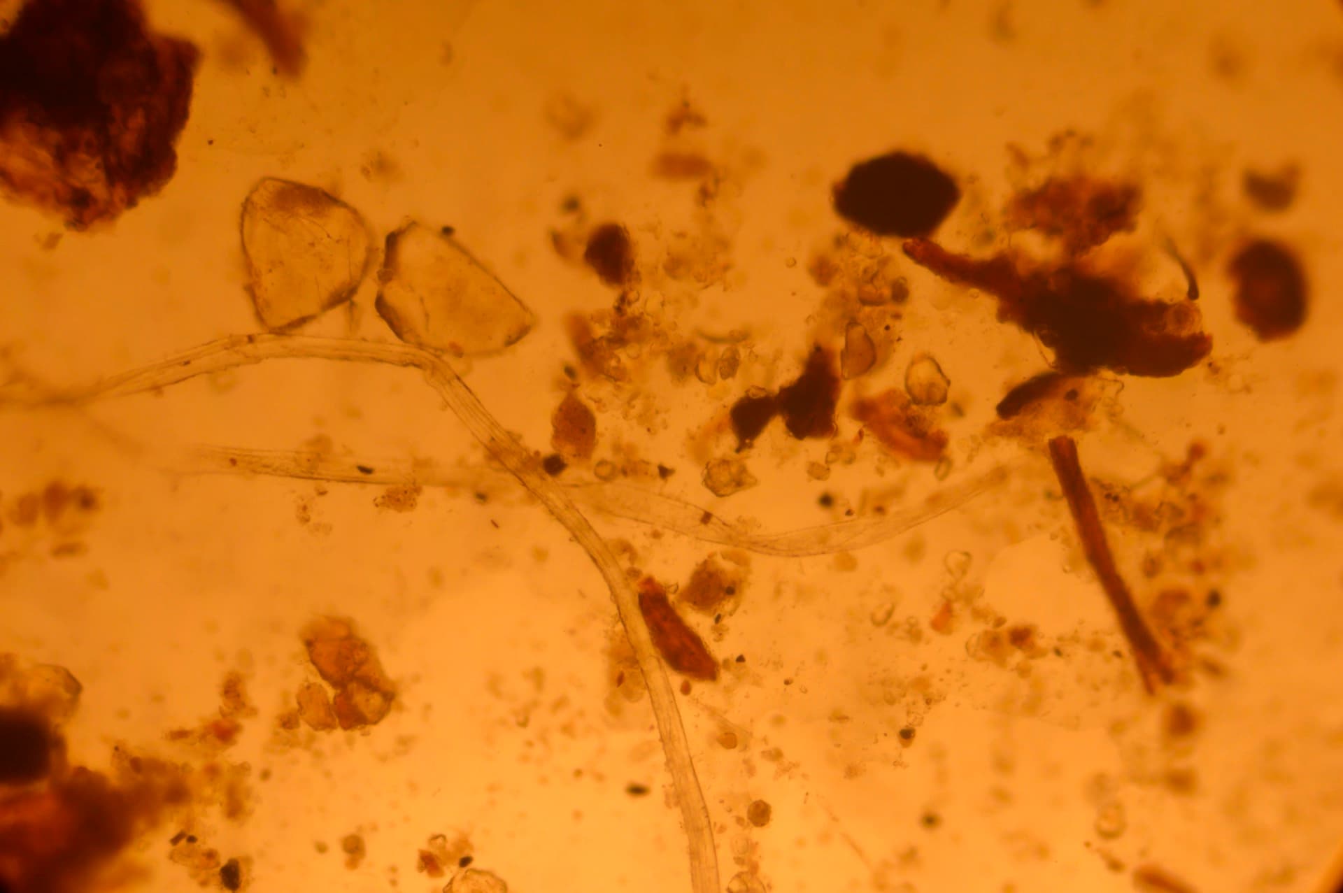 Microscopic Vision Restoration — plate 6